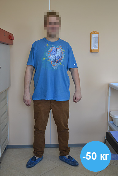 Слив-резекция - Фото пациента после операции