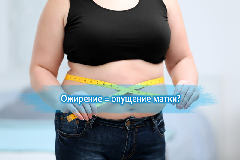Опущение матки как следствие ожирения